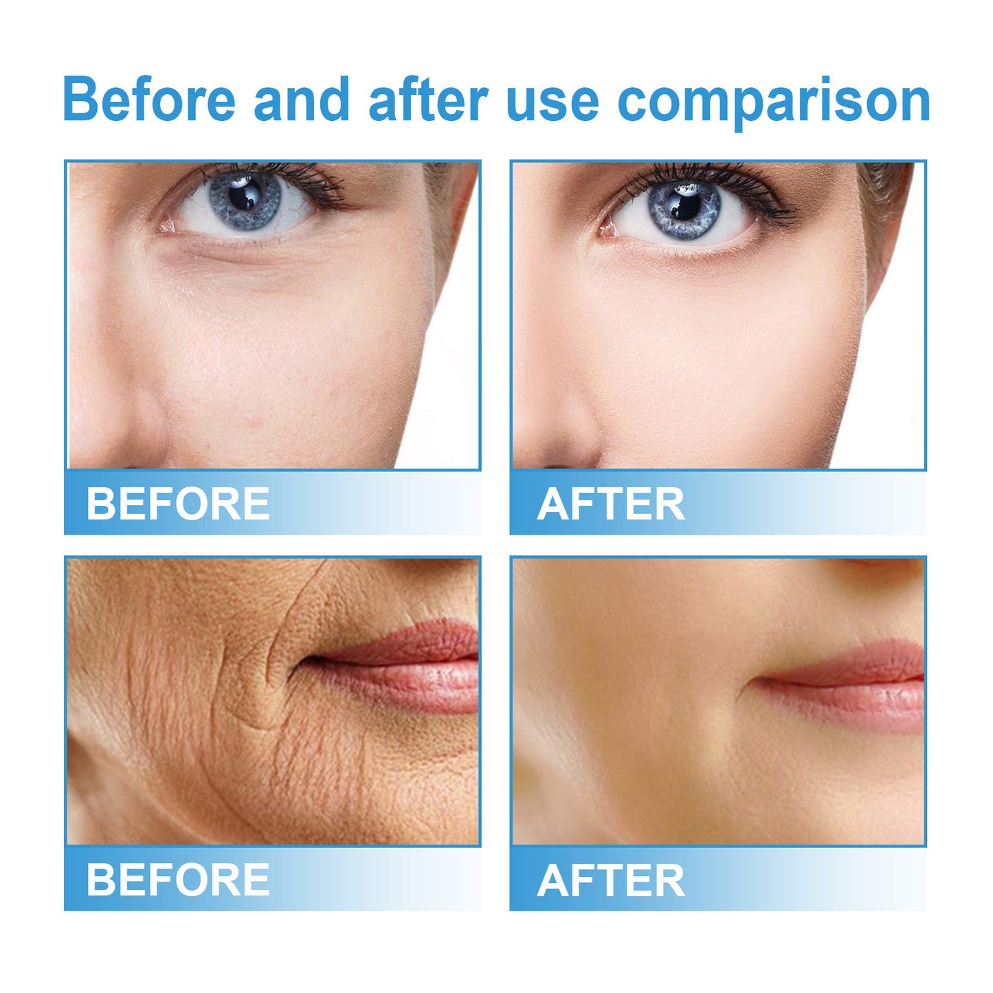 Nicotinamide Facial Brightening Skin Tone Firming Skin Hydrating Skin Moisturizing Lotion