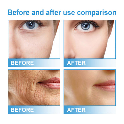 Nicotinamide Facial Brightening Skin Tone Firming Skin Hydrating Skin Moisturizing Lotion