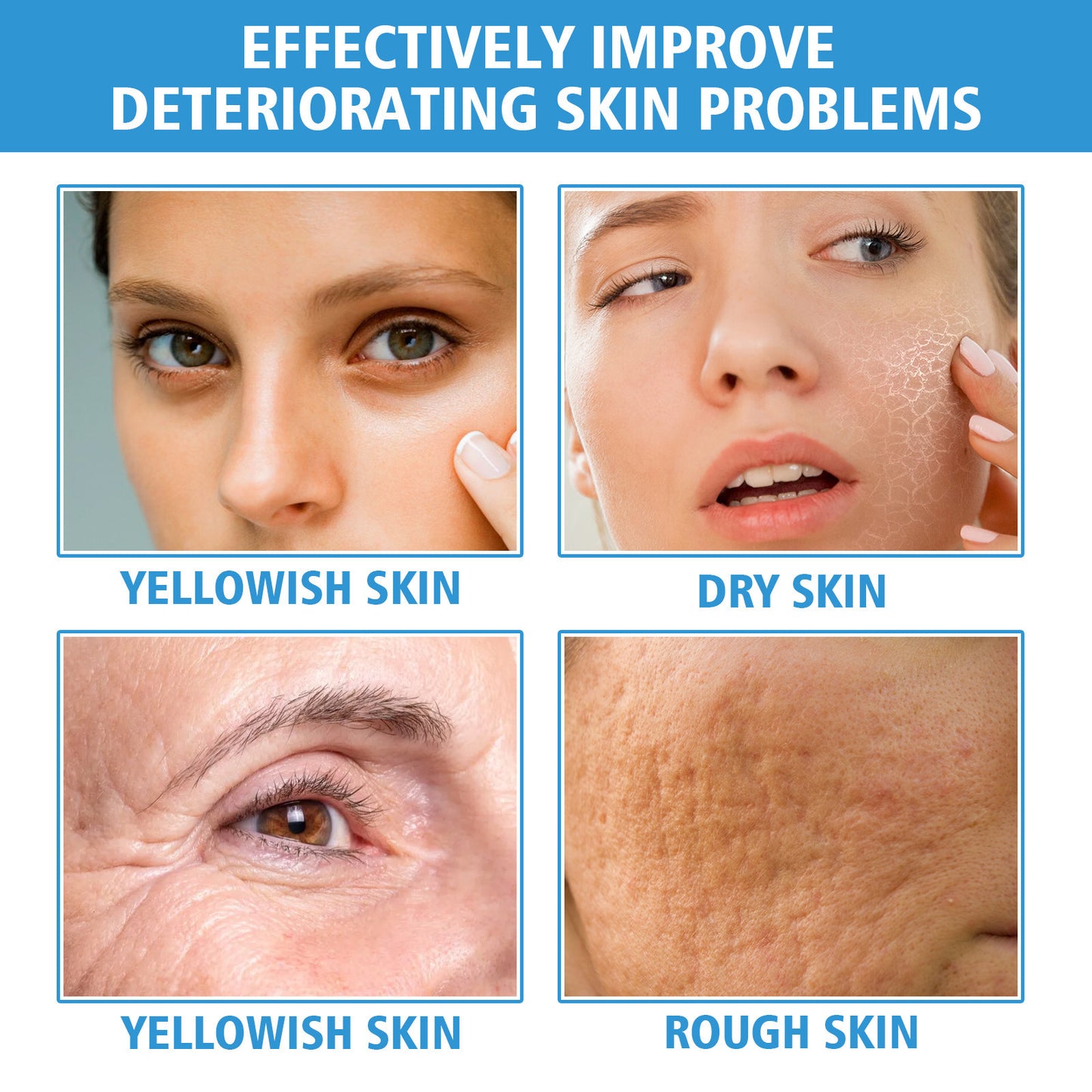 Nicotinamide Facial Brightening Skin Tone Firming Skin Hydrating Skin Moisturizing Lotion