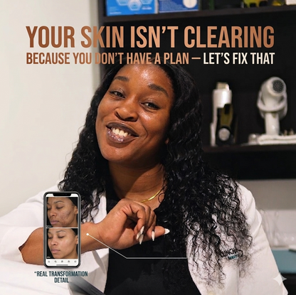 1:1 Clear Skin Strategy Session (Copy)