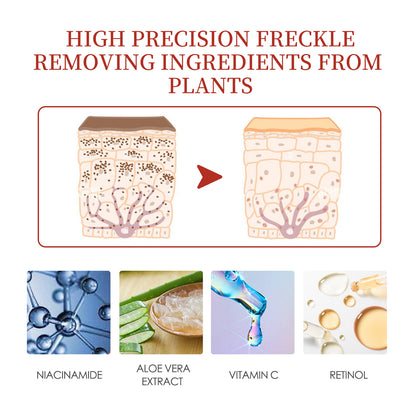EELHOE Color Repair Cream Replenishes, Moisturizes, And Lightens Freckles, Black Spots, Blemishes, Melasma, And Melanin Skin Cream