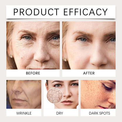 Moisturize And Improve Skin Dullness Essence