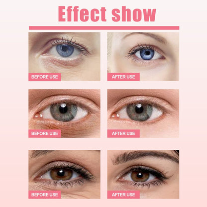 West&Month Rosehip Eye Cream Stick For Periocular Moisturization, Hydration, Fine Line Reduction, Dark Circle Mitigation, And Lifting And Firming The Eye Area